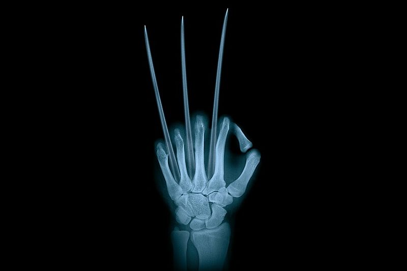 hand-2194170_960_720